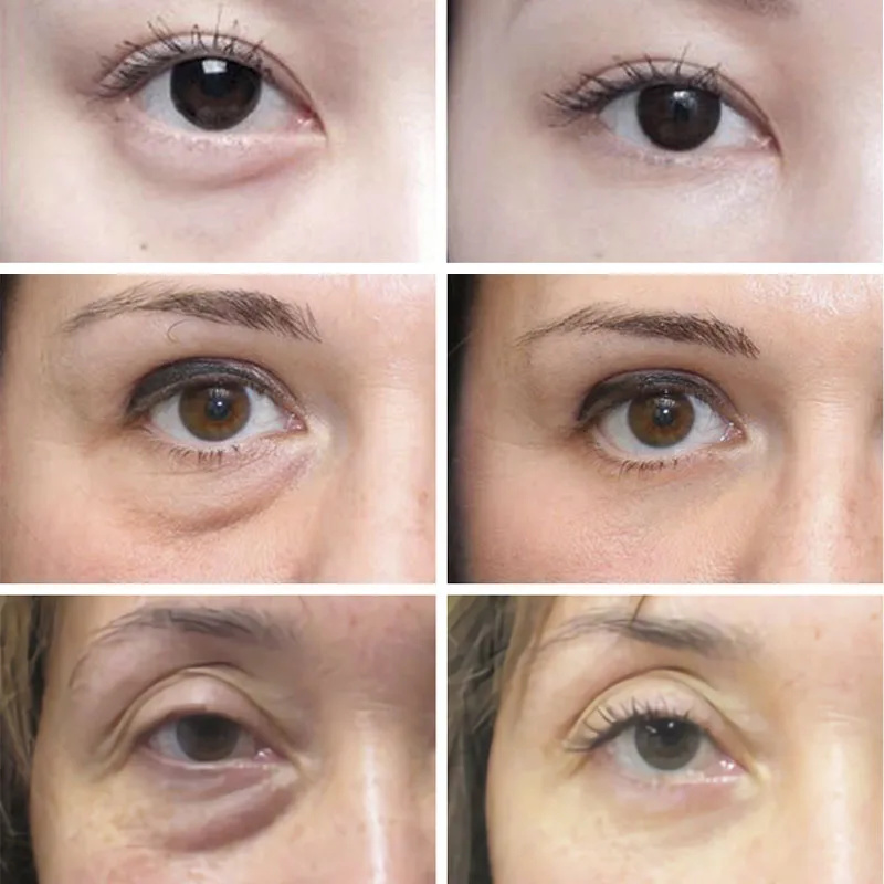 Anti Wrinkle Anti Dark Circle  - Retinol Anti Wrinkle Cream 评论和价格