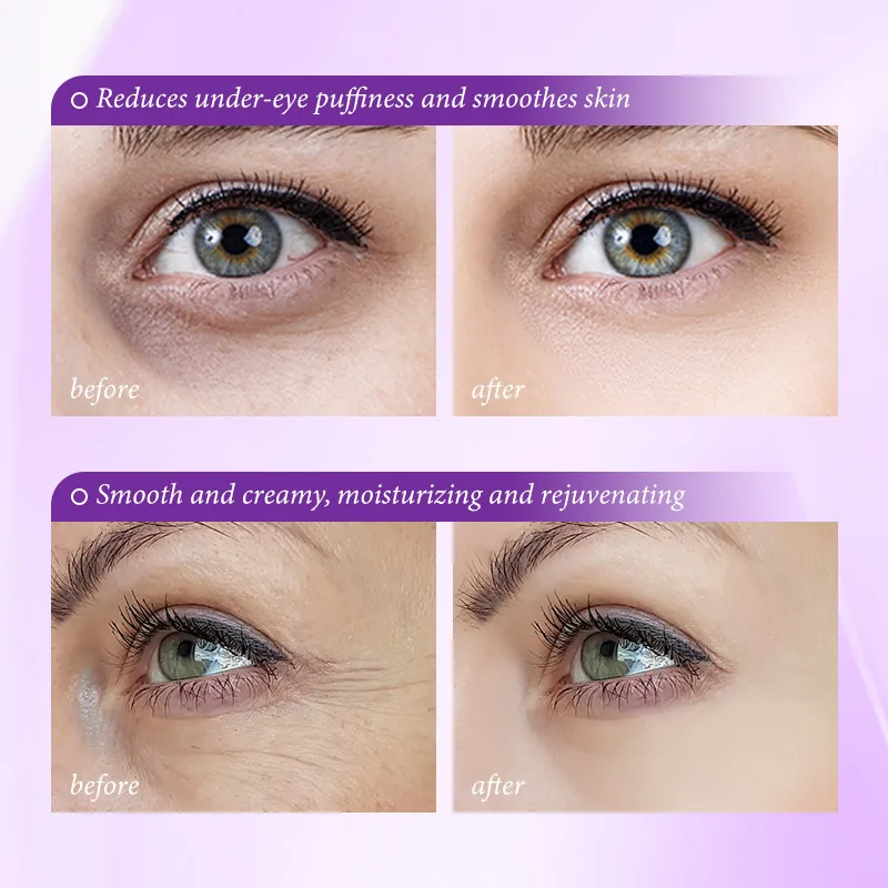 Instant Eye Bag Removal Cream  - Retinol Anti Wrinkle Cream 评论和价格