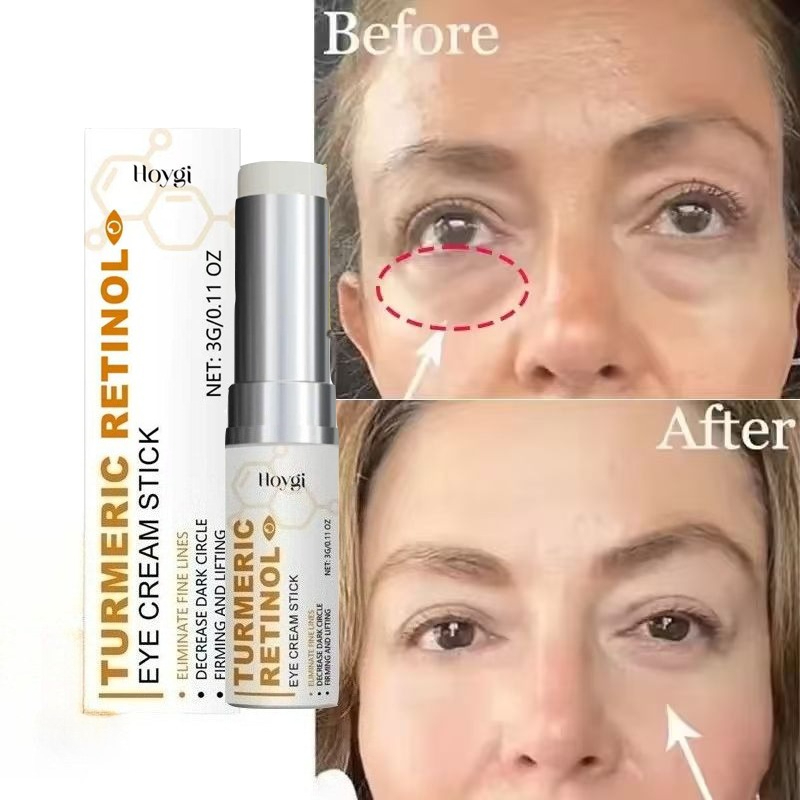 Instant Turmeric Eye Bag Remov - Retinol Anti Wrinkle Cream 评论和价格